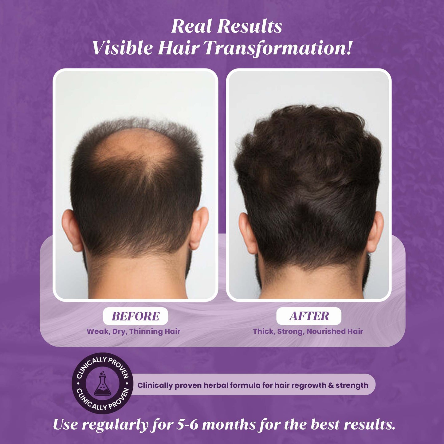 Gir Junglee Jadi buti Herbal Hair Oil - Gir Junglee